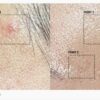 tc-spot-solution-1.jpeg TC Spot Solution 32 ml