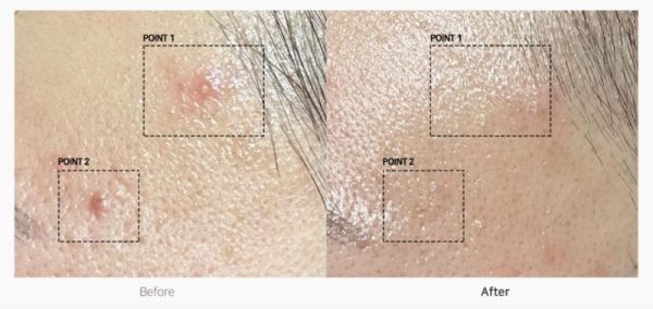 TC Spot Solution 32 ml - Görsel 2