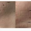 tc-spot-solution-2.jpeg TC Spot Solution 32 ml