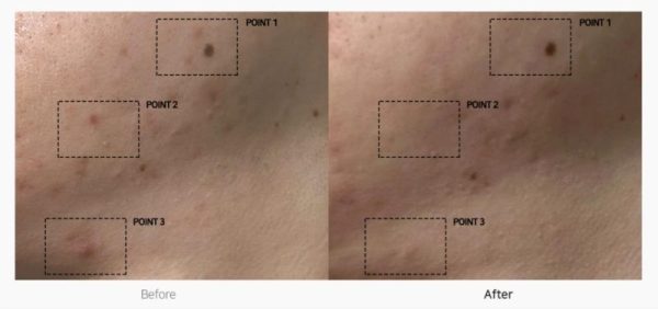 TC Spot Solution 32 ml - Görsel 3