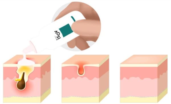 TC Spot Solution 32 ml - Görsel 5